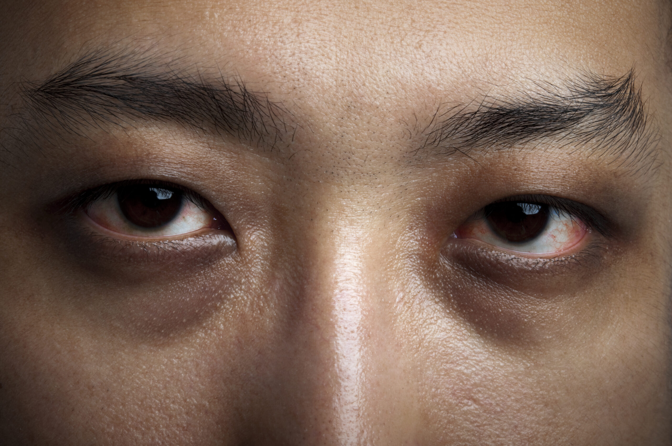 Черное вокруг глаз причины. Черные глаза мужские. Узкие глаза мужские. Человек с темными кругами под глазами. Азиатские глаза.